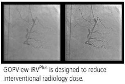 2008 11 05 13 04 47 543 Contextvision2 Adv 2008