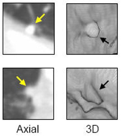 2008 11 05 16 34 28 345 Nomura newnodules