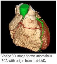 2008 11 06 13 22 07 628 Visage2 Adv 2008