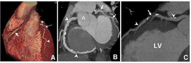 2008 11 11 14 43 21 265 Hoffman 40yomale