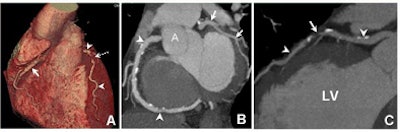 2008 11 11 14 43 21 265 Hoffman 40yomale