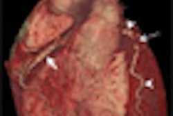 2008 11 11 14 43 22 787 Hoffman thumb 11 08