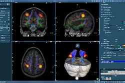 2008 11 12 17 20 12 529 In Vivo F Mri Sf1 F Resized