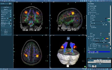 2008 11 12 17 20 12 529 In Vivo F Mri Sf1 F Resized
