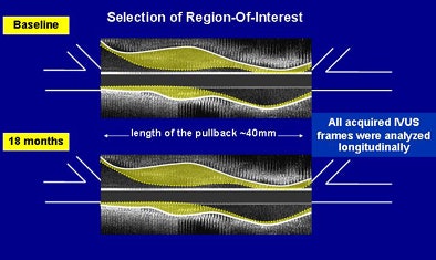 2008 11 13 16 22 28 336 Nesto ivus