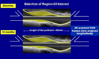 2008 11 13 16 22 28 336 Nesto ivus