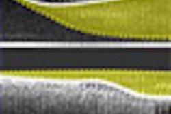 2008 11 13 16 22 29 19 Nesto thumb 11 08