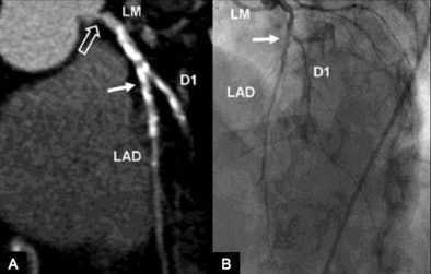 2008 11 17 12 19 39 788 Ruzsics top3