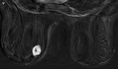 2008 11 17 15 20 26 886 Figure3 C Resized