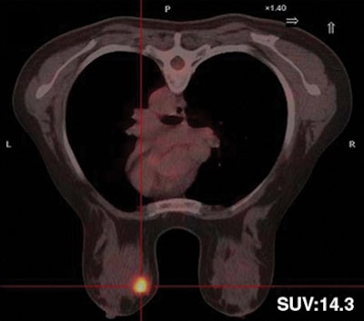 2008 11 17 15 20 30 168 Figure3 B Resized