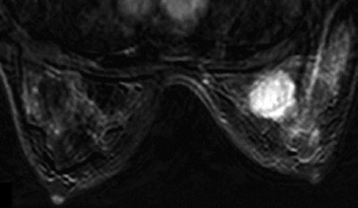 2008 11 17 15 20 34 700 Figure4 C Resized