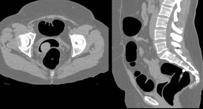 2008 11 17 16 44 57 512 Friedman vaginal