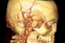 2008 11 21 10 13 43 546 Voxar3d Thumb