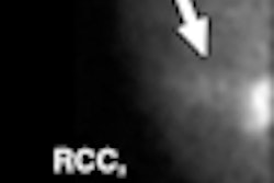 2008 11 21 12 31 42 882 Figure 4 Thumb
