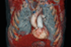 2008 11 21 16 32 44 971 Siemens Definition Lung Thumb