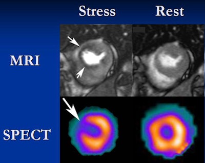 2008 11 30 15 59 30 276 Vogel stressbottom