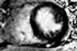 2008 11 30 15 59 30 489 Vogel thumb 11 30 08