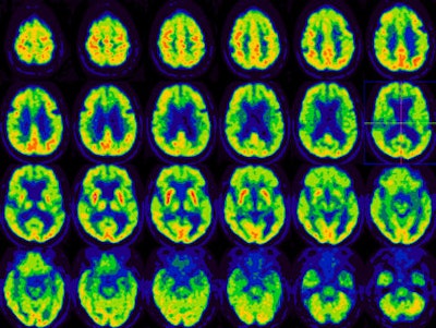 2008 12 02 14 20 59 870 Als Image2 Resized