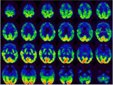 2008 12 02 14 21 02 540 Als Image1 Resized