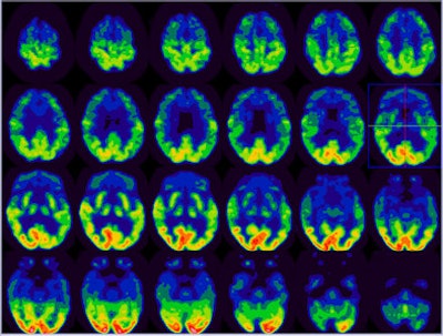 2008 12 02 14 21 02 540 Als Image1 Resized