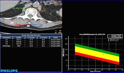 2008 12 02 17 43 32 323 Aslam bmdguibottom jpg