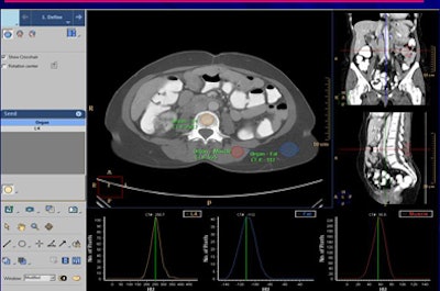 2008 12 02 17 43 34 209 Aslam bmdgui top