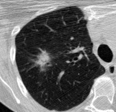 2008 12 11 13 17 23 503 Avila bottom