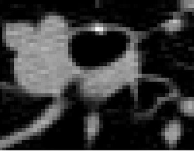 2008 12 11 13 17 24 427 Avila top