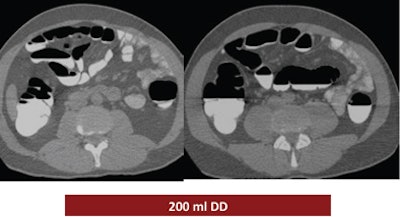 2008 12 15 15 02 21 536 Ferrari exampletop