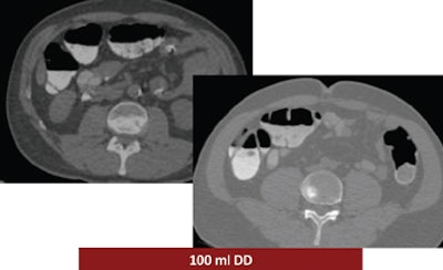 2008 12 15 15 02 22 69 Ferrari examplemiddle