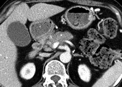 2008 12 31 14 41 32 827 Park top2a