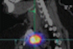 2009 01 02 10 59 03 130 Spect Planar Thumb