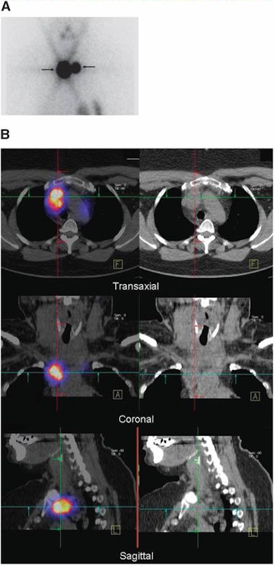 2009 01 02 10 59 03 416 Image Aand B