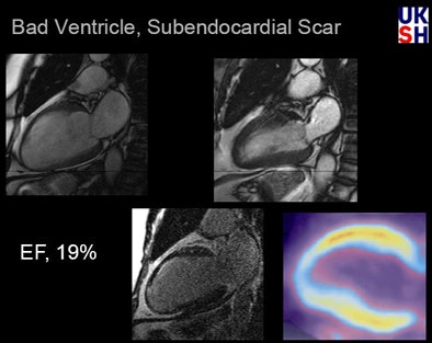 2009 01 02 15 20 50 397 Hunold patient19