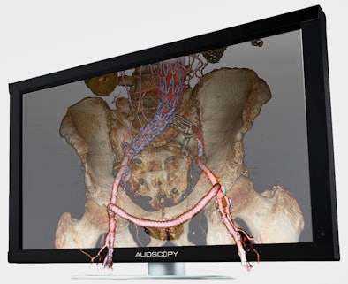 2009 01 08 15 25 43 177 Alioscopy Medical Image Resized