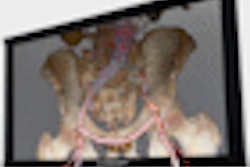 2009 01 08 15 25 43 909 Alioscopy Thumb