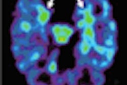 2009 01 12 14 06 03 120 Ucla Pet Brain Scans Thumb