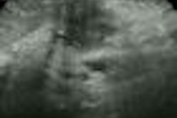 2009 01 16 17 33 00 312 Poley thumb 01 09 70