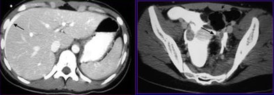 2009 01 20 15 53 51 486 Lemos casetwo