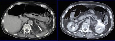 2009 01 20 15 53 58 742 Lemos casethree