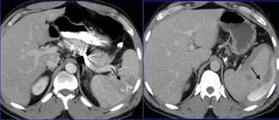 2009 01 20 15 54 04 724 Lemos caseone