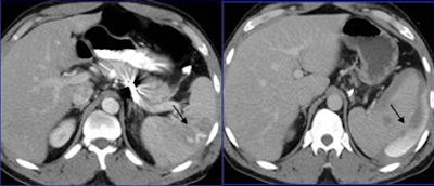 2009 01 20 15 54 04 724 Lemos caseone