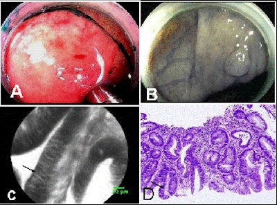 2009 01 29 13 42 47 62 Buchner microendoscopy