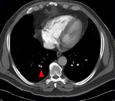 2009 02 03 15 08 14 407 Suh smallpe2