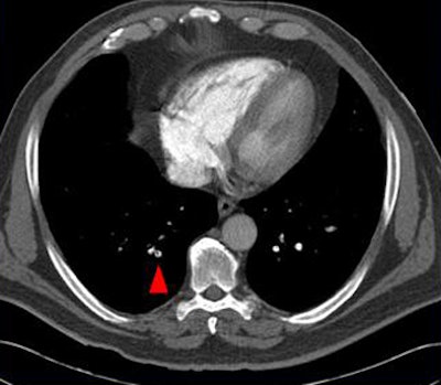 2009 02 03 15 08 14 407 Suh smallpe2