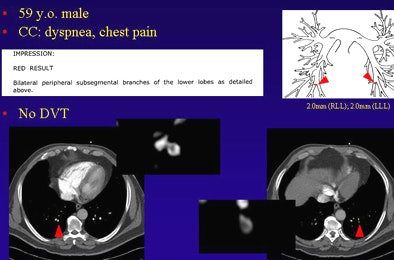 2009 02 03 15 08 16 756 Suh patient2bottom