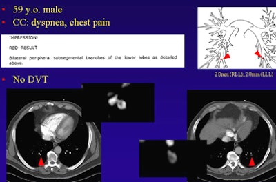 2009 02 03 15 08 16 756 Suh patient2bottom
