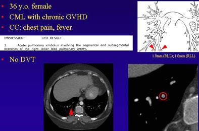 2009 02 03 15 08 18 662 Suh patient1top