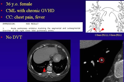 2009 02 03 15 08 18 662 Suh patient1top