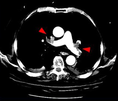 2009 02 03 15 08 20 317 Suh largepe2